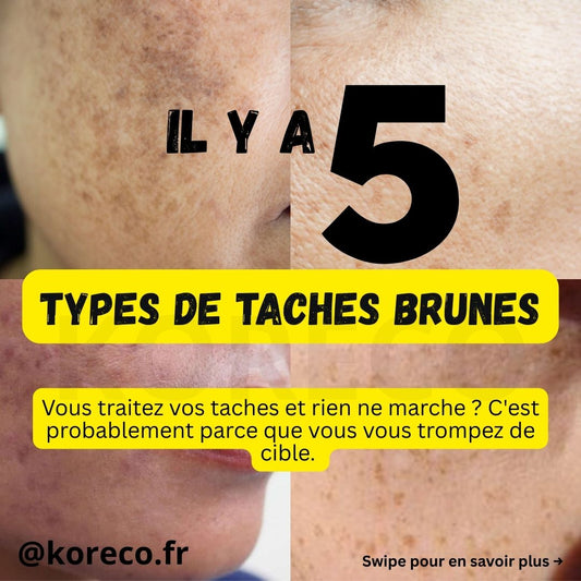 Les 5 principaux types de taches pigmentaires sur le visage et comment les traiter