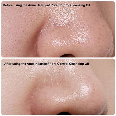 ANUA- Heartleaf Pore Control Cleansing Oil 200ml